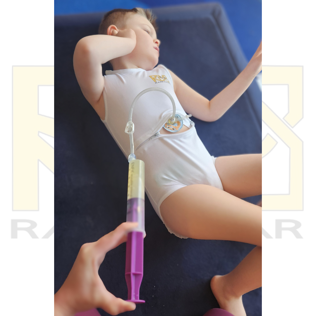 White OneEase Adaptive Onesie – medical access feature